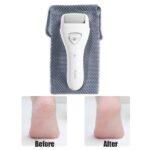 Doco Electric Callus Remover