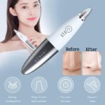 Xiaomi inFace Blackhead Remover